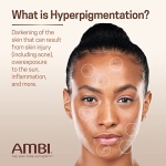 Ambi Even & Clear Fade Cream, Hydroquinone-free, Hyperpigmentation Treatment, Dark Spot Corrector, Results In As Little As 4 Weeks, Niacinamide, Aloe Vera, Vitamin C, 1 Fl Oz - Image 6